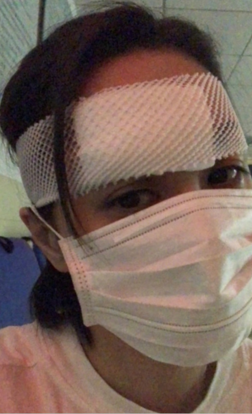 钟欣潼|阿娇术后半月复工高清照曝光，戴口罩帽子不见右眉伤口，清瘦不少