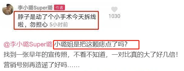 李小璐|李小璐被拍现身整容科，她大方晒美照，网友评论扎心：这鼻子垫的