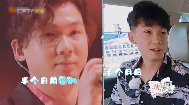 整容|90后男歌手自曝整容经历！打瘦脸针导致面瘫，至今仍有心理阴影