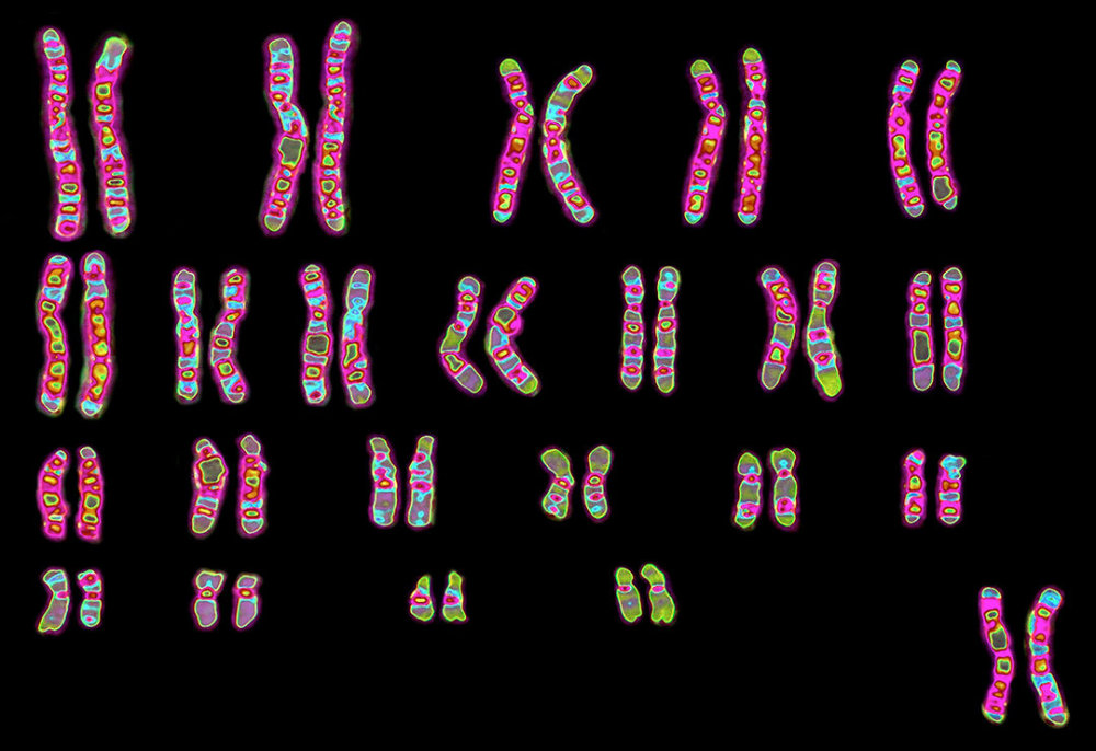 黑猩猩|人类和黑猩猩有生殖隔离吗？苏联科学家找来5名女性，结果怎样？