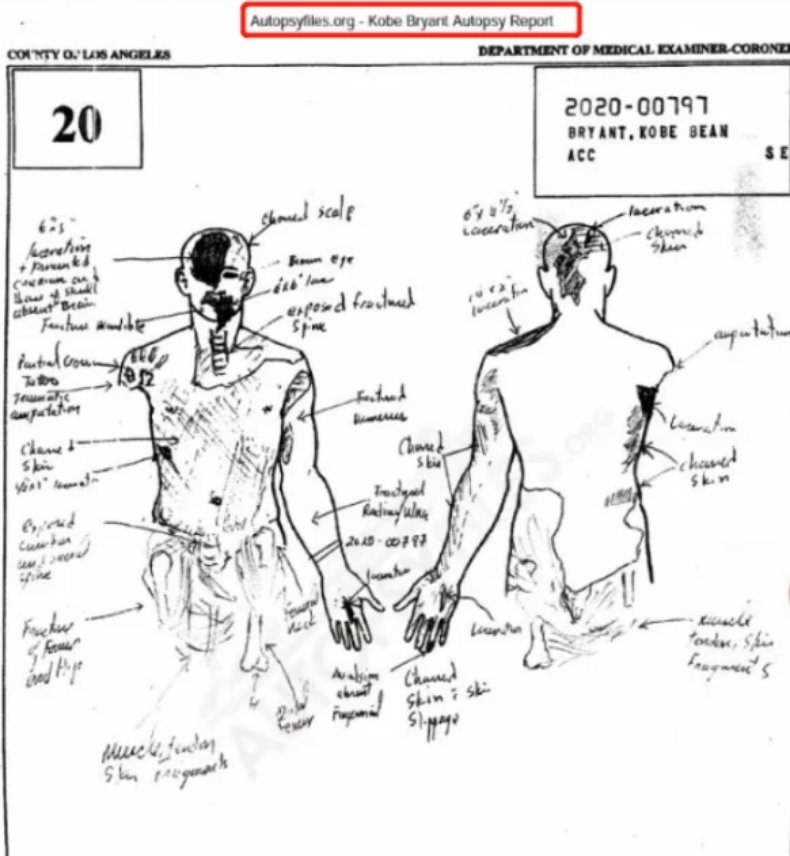 瓦妮莎|科比大量遗骸照遭泄露，嫌疑人却删除证据否认，瓦妮莎悲痛起诉