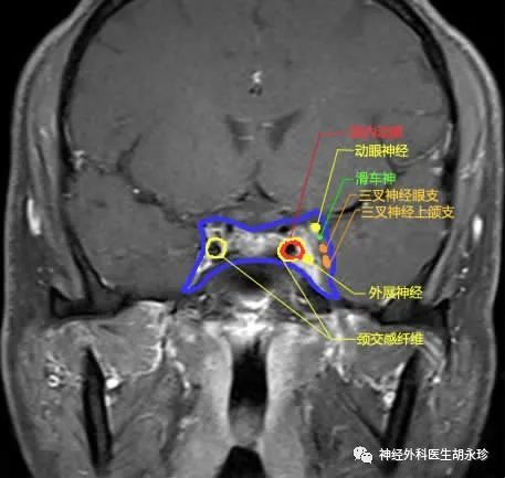 无汗|眼裂减小，颜面无汗，瞳孔缩小，要注意这类疾病