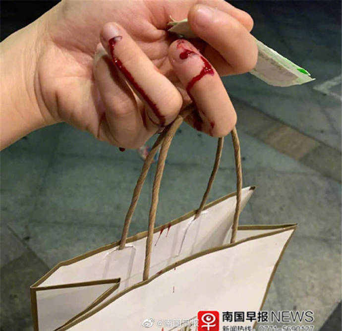 小区单元楼玻璃门突然破碎,南宁 一女子手指被刮伤缝5针