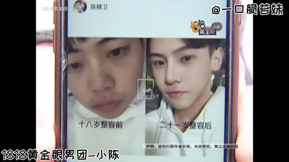 1818黄金眼|人家割伤的是手，你们却都在看脸？1818全组都是星探吗？