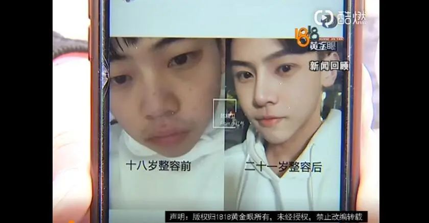 月嫂|赢就赢在这张脸上了……