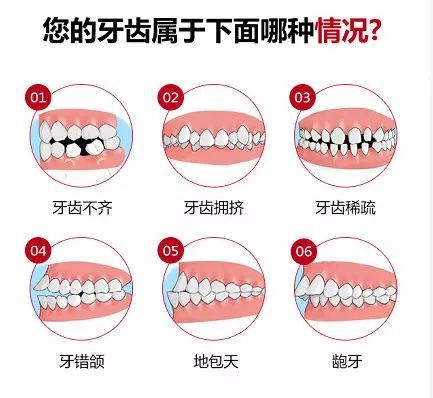 牙齿矫正需要多长时间？