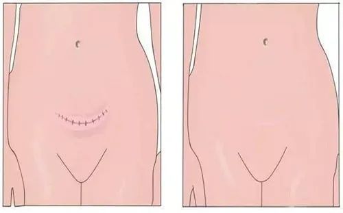 罗志祥|罗志祥后又一玩咖摊上大事了！他当年可是狙击万千少女的心啊……