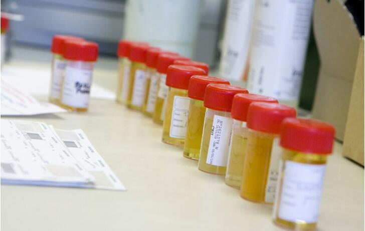 肾病|肾病有4项尿液指标非常重要，查清有利于降蛋白，别漏了