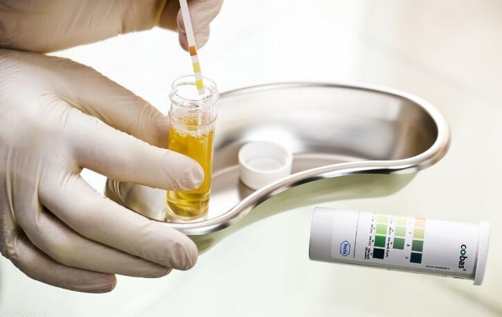 肾病|肾病有4项尿液指标非常重要，查清有利于降蛋白，别漏了