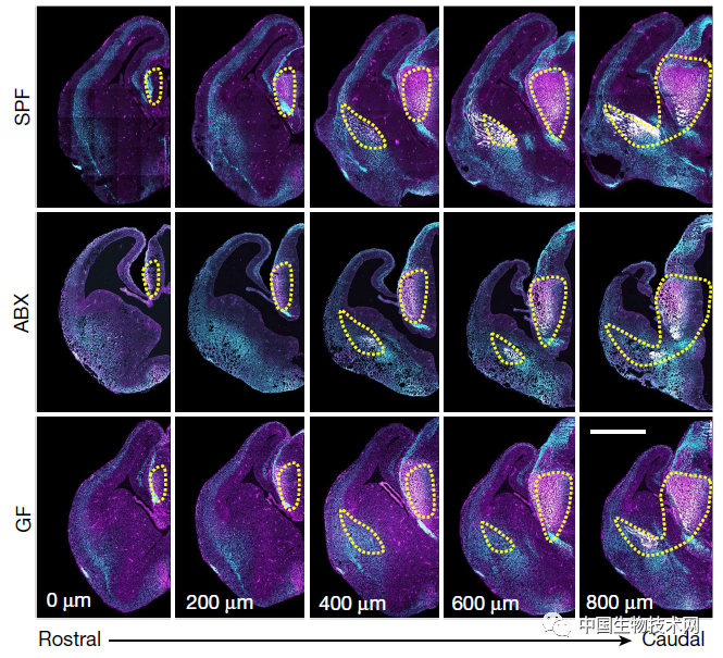 肠道微生物组|又见“肠-脑”重磅研究！Nature：孕妇肠道菌群在影响胎儿的大脑发育