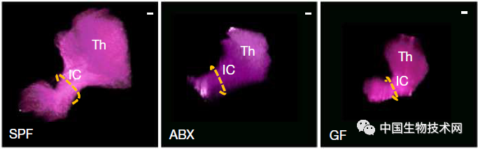 肠道微生物组|又见“肠-脑”重磅研究！Nature：孕妇肠道菌群在影响胎儿的大脑发育