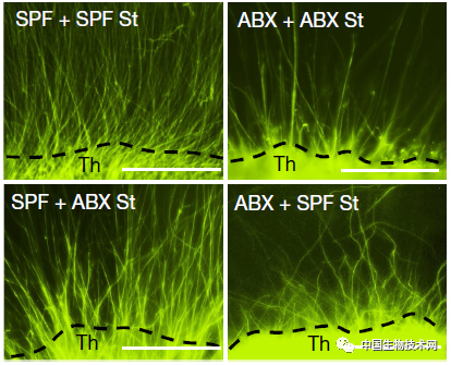 肠道微生物组|又见“肠-脑”重磅研究！Nature：孕妇肠道菌群在影响胎儿的大脑发育