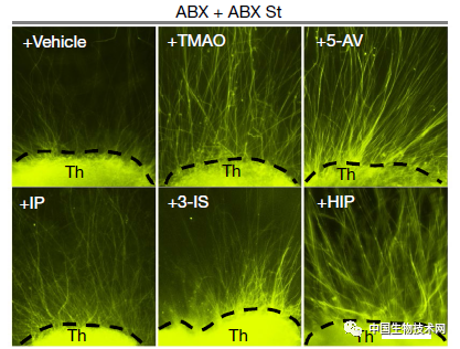 肠道微生物组|又见“肠-脑”重磅研究！Nature：孕妇肠道菌群在影响胎儿的大脑发育
