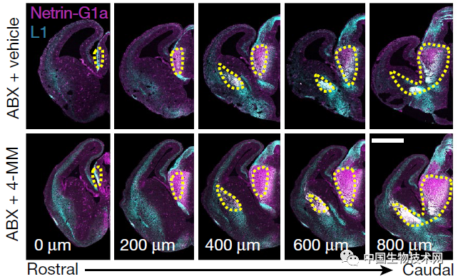肠道微生物组|又见“肠-脑”重磅研究！Nature：孕妇肠道菌群在影响胎儿的大脑发育