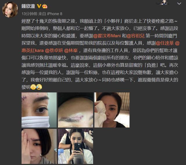 钟欣潼|阿娇受伤后首晒自拍照，伤口触目惊心，坦言留疤感叹遮瑕膏的发明