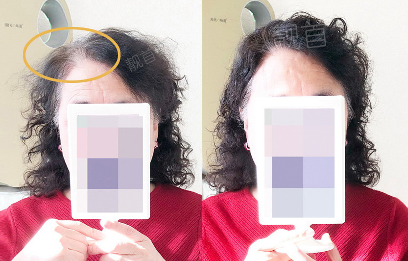 假发|用真发定做假发在哪买到？