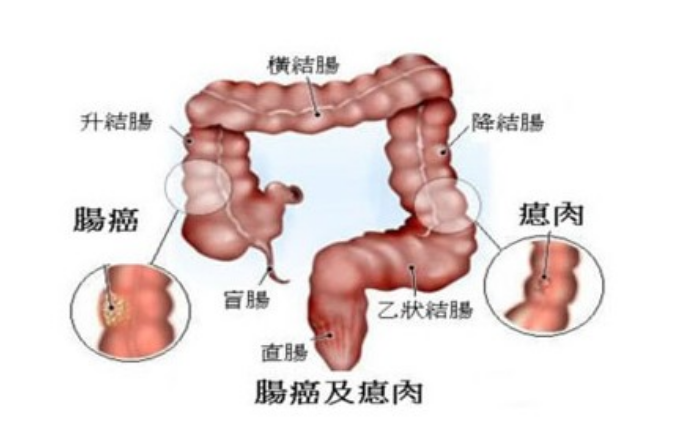 大便结构图图片