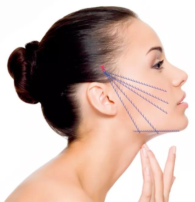 做了线雕多久几天可以化妆,做线雕后要注意些什么东东?