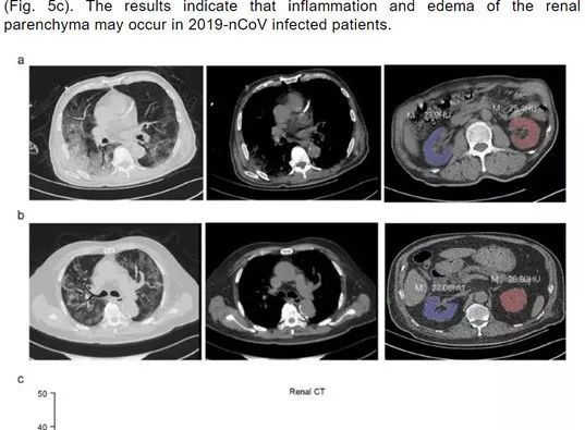 后遗症|一周内死亡翻倍！缅甸疫情来势汹汹！新冠后遗症给缅甸敲响警钟
