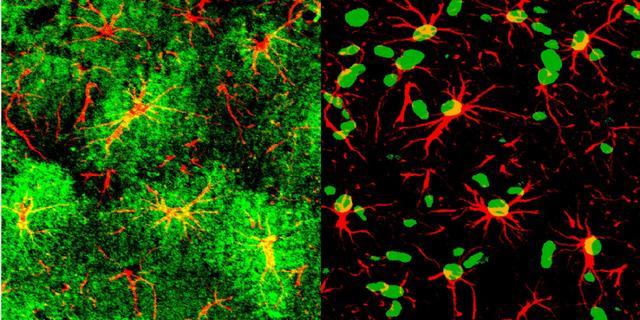 神经胶质细胞|神经胶质细胞功能与疾病大会即将进行，浙大团队连续发文