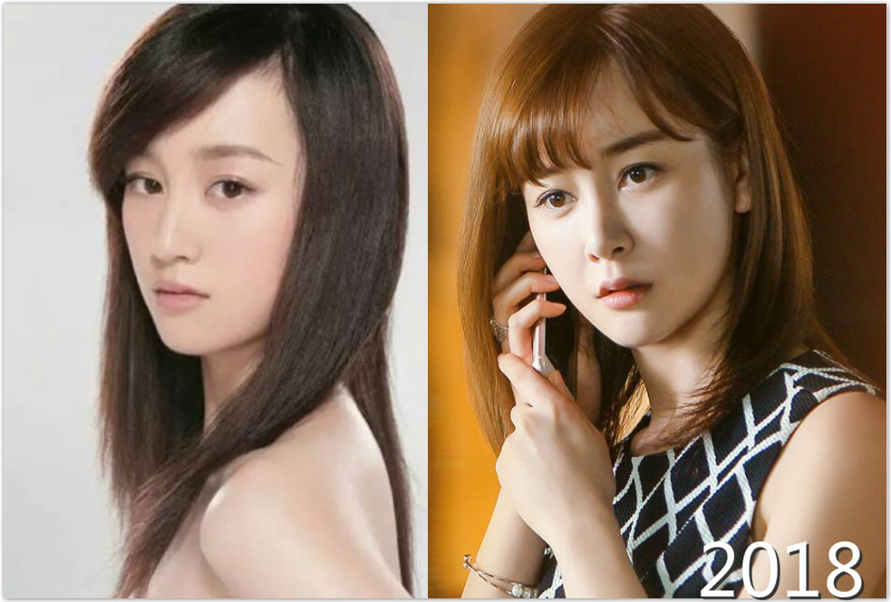 整容|明星整容早已是公开的秘密，难就难在她们不懂“见好就收”