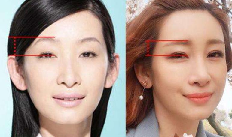 秦海璐是因为特殊原因去整容,那么戚薇就是纯粹为了更上镜.