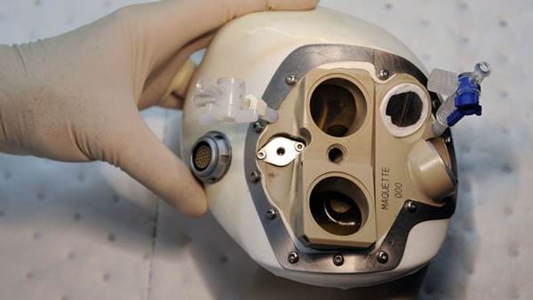 临床试验|医学领域突破，中国国产“人工心脏”进入临床试验，未来可期