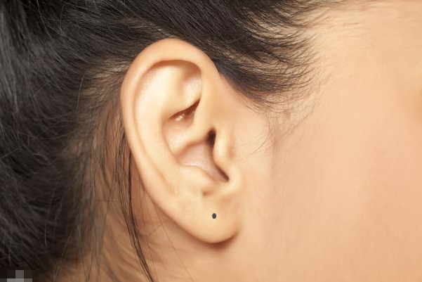 1,耳垂上长痣:耳垂有痣的人天生孝顺,单纯善良,有着很好的福缘.