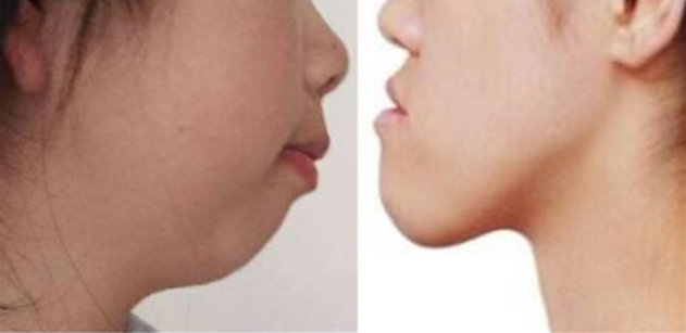 颜值|曾经全网为她哭瞎眼，如今带着一张惊艳众人的脸杀回来了