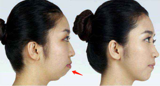 颜值|曾经全网为她哭瞎眼，如今带着一张惊艳众人的脸杀回来了