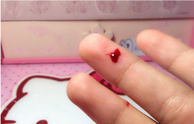 肺痨|现在这4种小病，在古代就是绝症，不能预防只能白白等死！