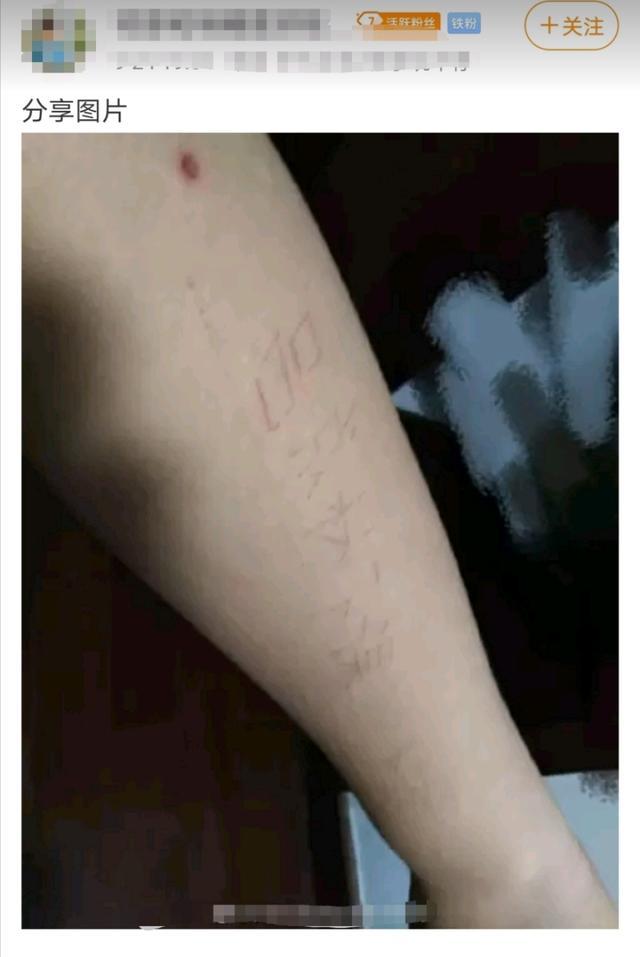 猫神事件出现极端粉丝手臂刻字吕成林下课如此疯狂大可不必