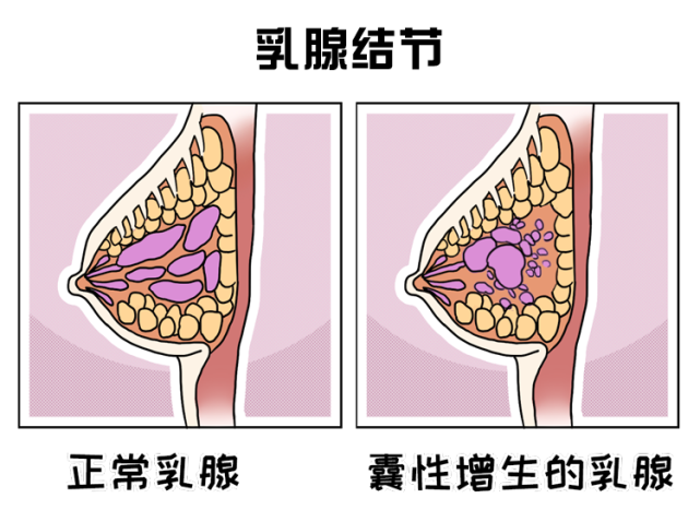 乳房点位怎么划分图片