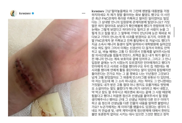 权珉娥|韩国女星与签约不到半年公司解约，坦言想说的很多，但不能全说