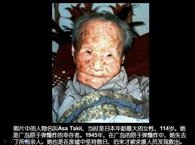 广岛原子弹爆炸:造成275230人死亡,幸存者眼中充满了绝望