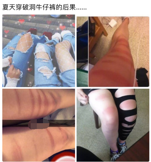 女网友分享穿破洞牛仔裤的后果……哈哈哈,看着太心疼了!