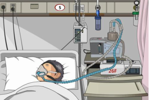 呼吸衰竭|为什么会出现呼吸衰竭？