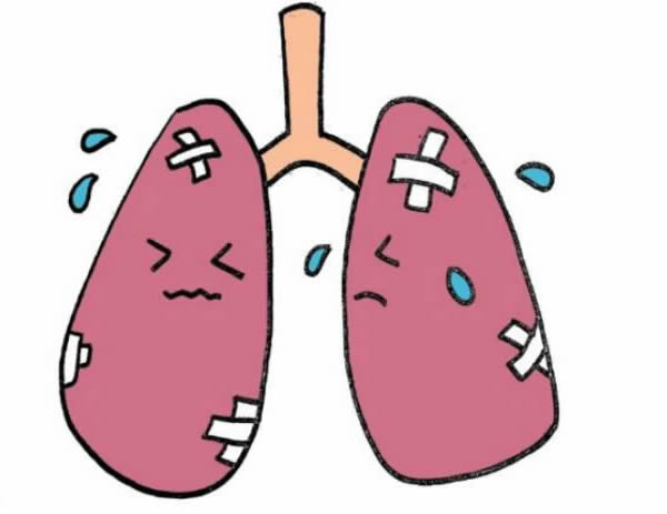 什么是肺炎链球菌肺炎