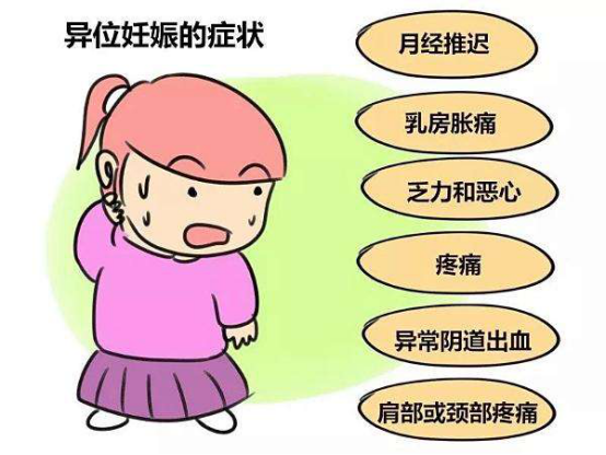异位妊娠的症状是什么 异位妊娠 输卵管