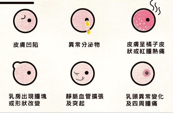 什么是乳腺癌_腾讯新闻