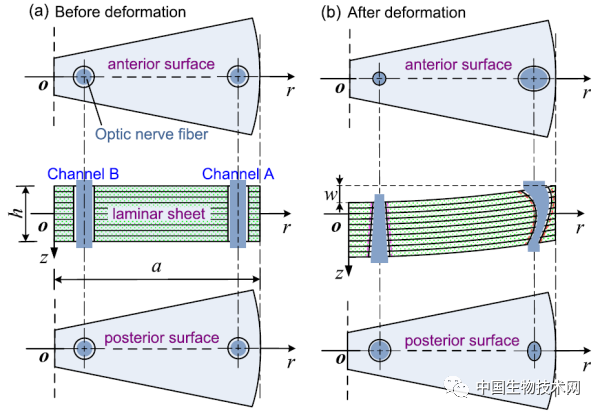 力学|力学所在青光眼致病机理研究中获进展