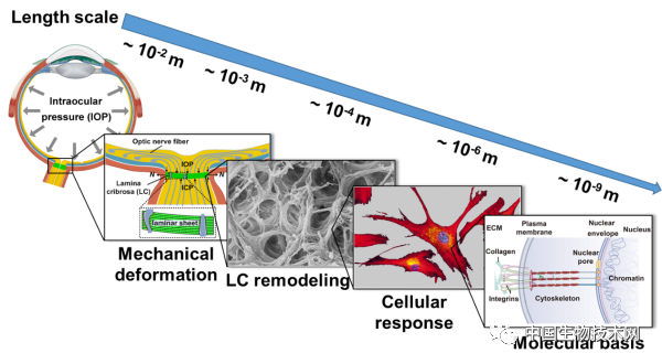 力学|力学所在青光眼致病机理研究中获进展