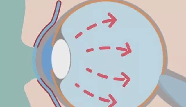 从视盘开始后穿过脉络膜冀巩膜筛板出眼球进入颅内至视交叉前角止