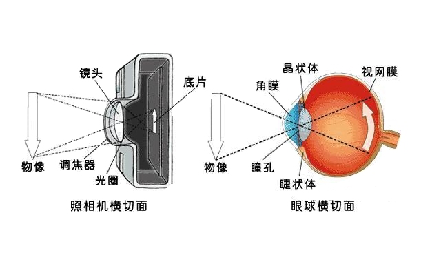 青光眼|青光眼 视神经萎缩损伤的因素？你知道吗？