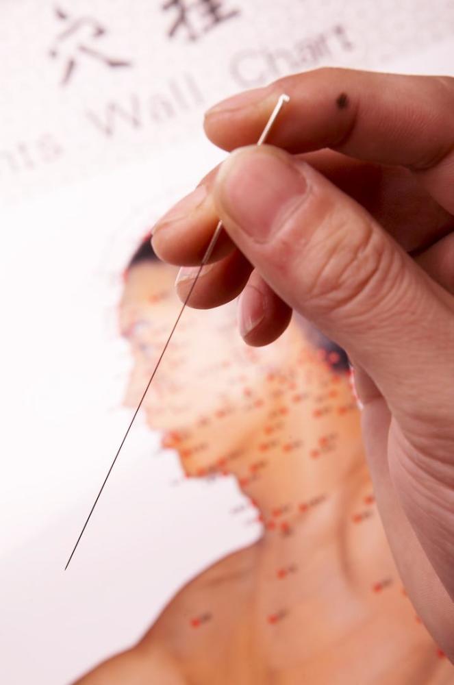 经过四诊合参,辨证选穴,同时配以董氏奇穴,甩尾挂针法,咬合线挑刺法及