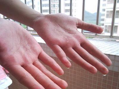 手汗症应该怎么治疗呢？