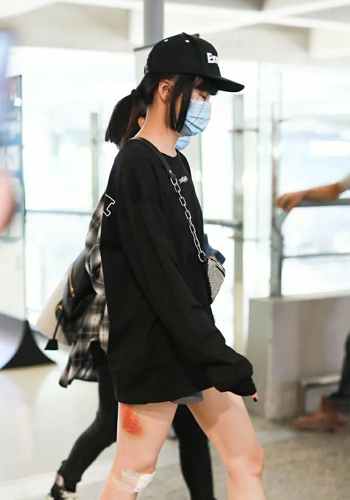 芒果|舞台事故找这种借口，当观众傻吗？