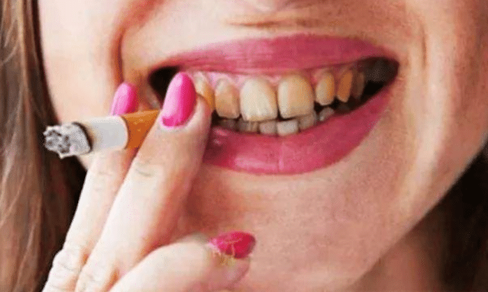 长期抽烟牙黄还有口臭?牙医有3招"土办法",还你清新口气
