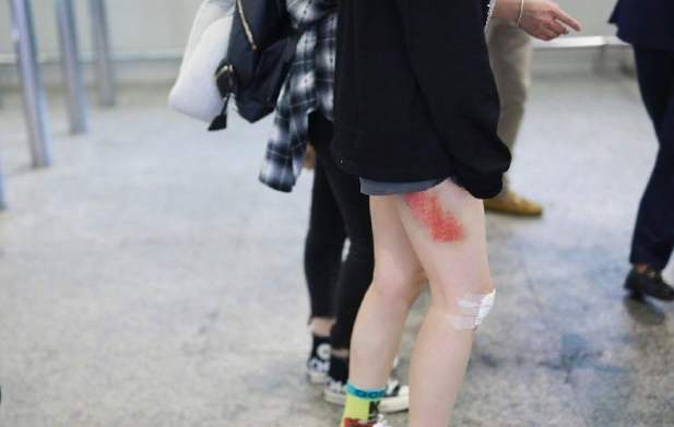 黄龄|黄龄发文回应舞台事故，调侃自己有九条命，摔得肉疼但却心里暖暖