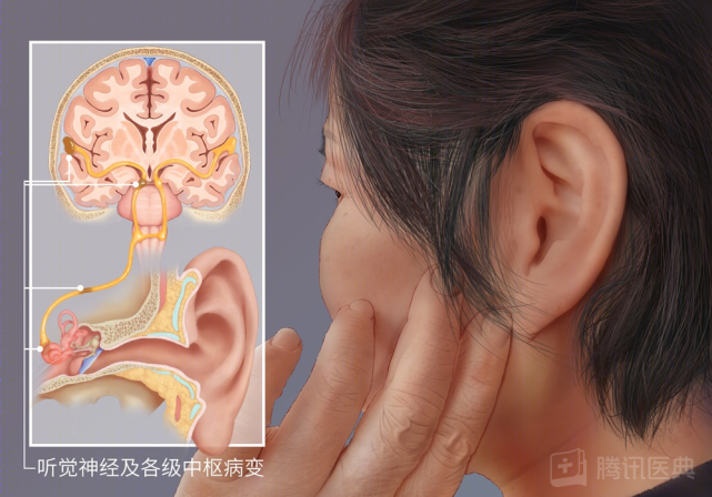 听力障碍是指听觉系统中传音,感音及其听觉传导通路中的听神经和各级